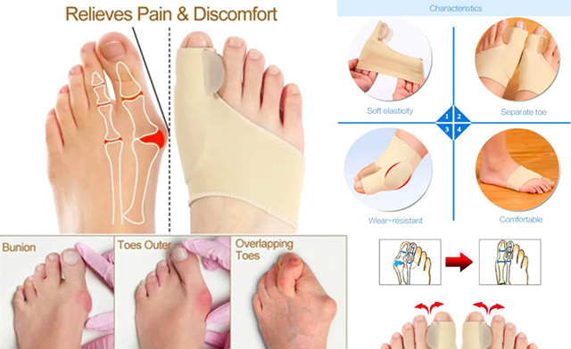 Image of $15 for a Pair of Bunion Correctors (a $35 Value)