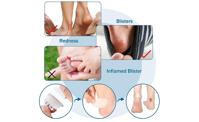 Image of $22.95 for Heel Blister Bandages - 50 Pcs (a $50 Value)