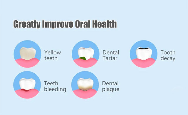 Image of $27.95 for a Rechargeable Water Flosser (a $60 Value)