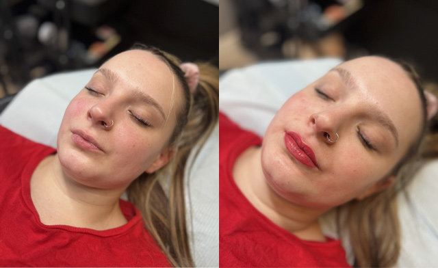 Image of $199 for a Lip Blush Treatment at A&A Medical Aesthetics