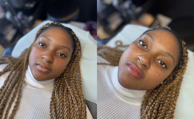 Image of $199 for a Lip Blush Treatment at A&A Medical Aesthetics