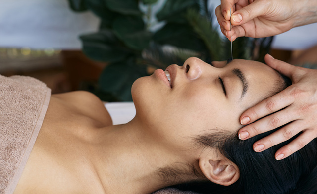 Image of $48 & Up for Cupping, Acupuncture, Gua Sha & Combo Treatments