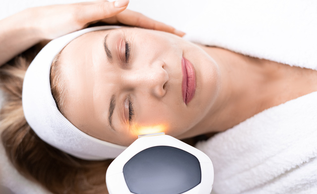 Image of FLASH SALE! $20 for an IPL Facial at BeautiFly Medi Spa