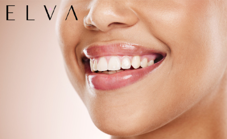 $64 for a 1-Hour Teeth Whitening at Elva Medical Aesthetics in Hamilton
