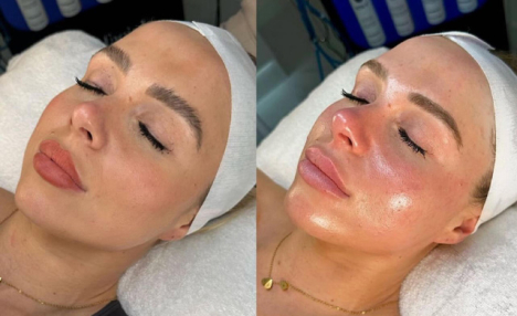 $69 & Up for Aesthetic Services from Body Bliss Aesthetics in Yorkville