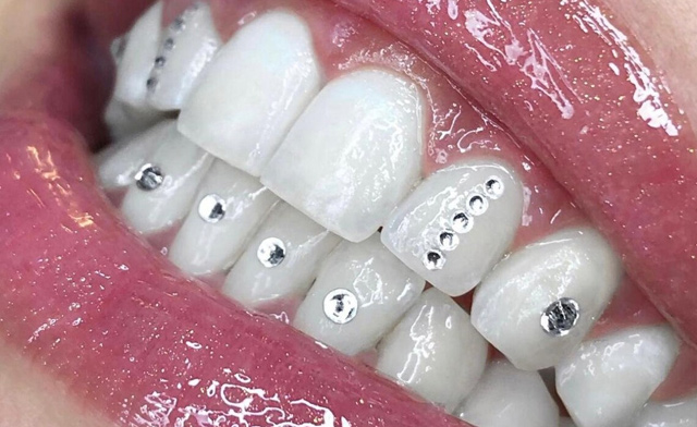 Image of $19 for a Swarovski Tooth Gem at Summer Sun Salon (a $40 Value)