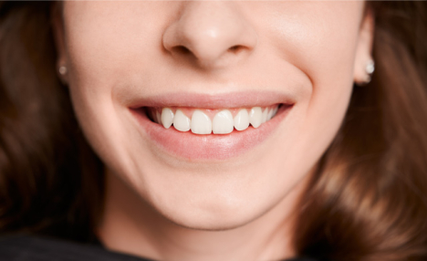 $39 for a 1-Hour Teeth-Whitening Session at Summer Sun Salon (a $99 Value)