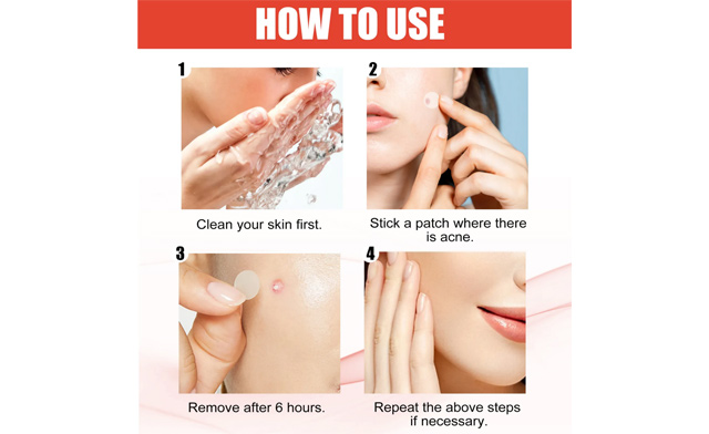 Image of $39 for 720 Transparent Medical-Grade Pimple Patches (a $69.99 Value)