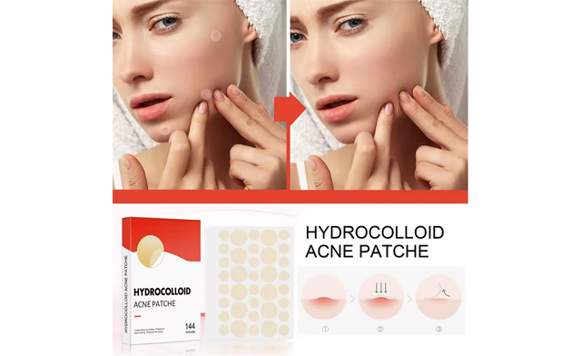 Image of $39 for 720 Transparent Medical-Grade Pimple Patches (a $69.99 Value)