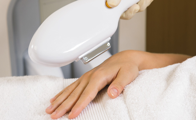 Image of FLASH SALE! $19 for an IPL Facial or Hand Treatment at Elva Medical Aesthetics in Hamilton