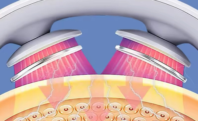 Image of $29 for a Portable Rechargeable Heated EMS Neck Massager (a $104.99 Value)