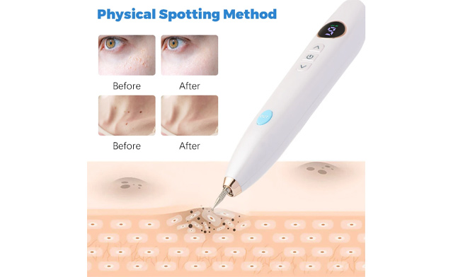 Image of $29.95 for a Blemish Removal Plasma Pen (a $53.08 Value)