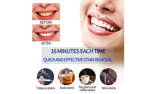 Image of $19.95 for a Portable Cold Light Teeth Whitening Kit (a $29.99 Value)