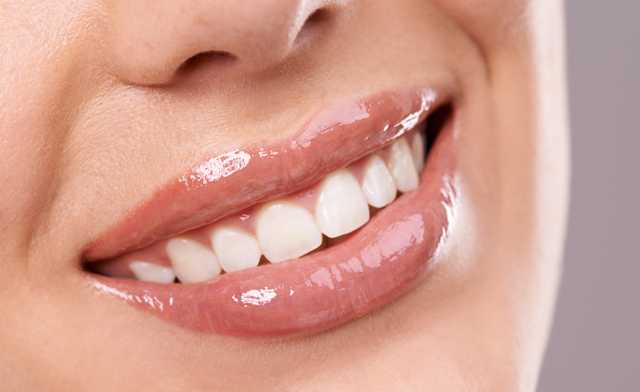 Image of $39 for One Double Teeth Whitening Session + a $20 Gift Certificate at Pure Glow