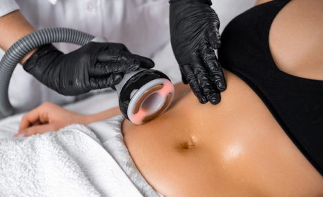 $39 for a 1-Hour Laser Lipo Procedure + a $20 Gift Card at ArtiQ