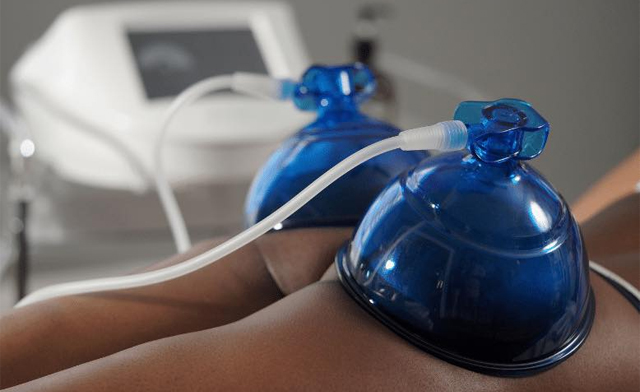 Image of $39 for a Vacuum Glute Lift + a $20 Gift Card at ArtiQ