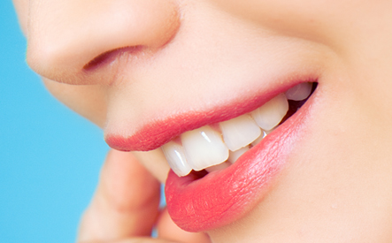 Image of $49 for a Professional In-Office Teeth Whitening at Springdale Family Dental or Ray Lawson Family Dental ($250 Value)