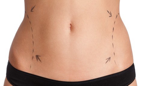 $199 for 2 iLipo Body Contouring Sessions (a $500 Value) $199 for 2 iLipo Body Contouring Sessions (a $500 Value)