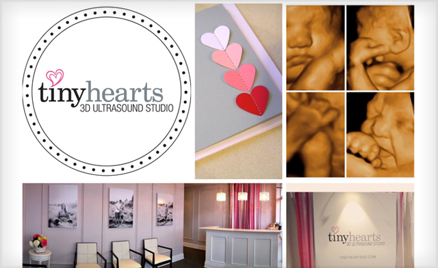 Image of Up to 45% off 3D Ultrasound Packages in Oakville