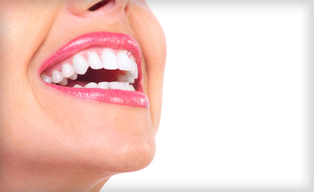 Image of $19 for a Bright Express Teeth Whitening Kit (a $49 Value)