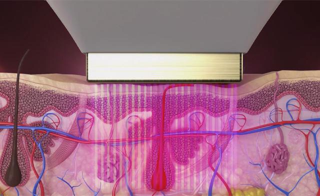 Image of Dermedica Laser and Spa