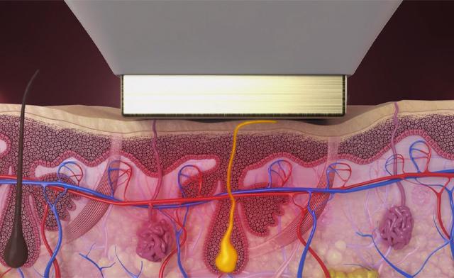 Image of Dermedica Laser and Spa