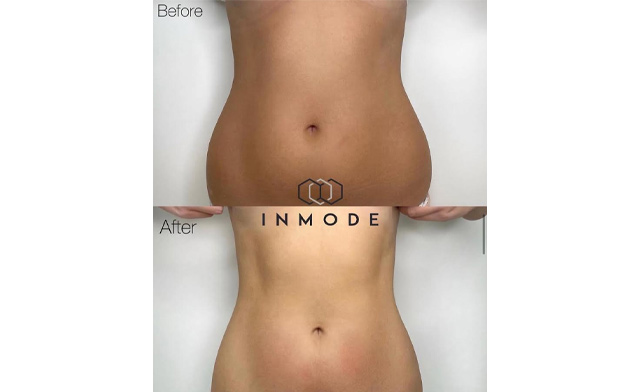 Image of Body Bliss Aesthetics