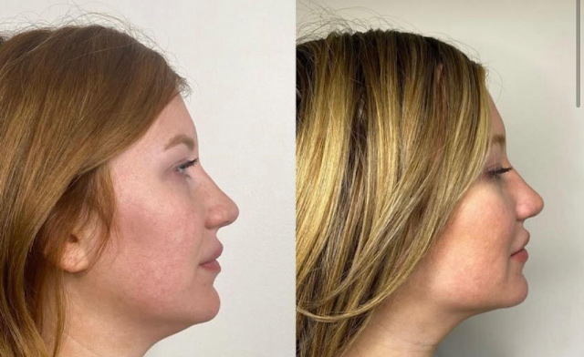 Image of Body Bliss Aesthetics